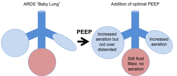 8/ With PEEP, we add another element. Using PEEP we can recruit more aerated alveoli. This leads to more surface area for gas exchange and improved oxygenation AND increased functional lung size. The increased size of the “baby lung” can increase Crs and decrease lung stiffness