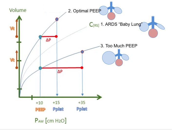 14/ Changing PEEP changes Crs (slope of the line)Add optimal PEEP we recruit alveoli, the compliance increases and the curve shifts up and to the left (line 1 to line 2) Add too much PEEP, we over-distend, worsen compliance and the curve shifts down and to the right (line 3)