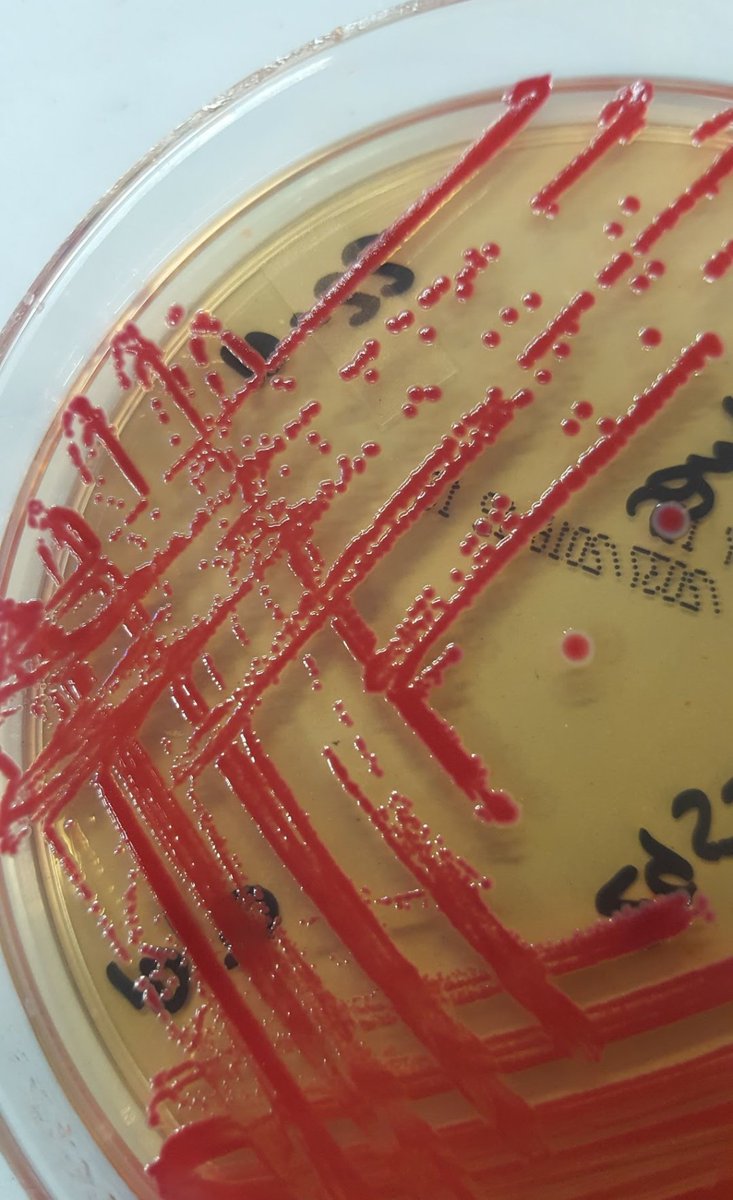 falcon94's tweet photo. @richdavisphd Happy birthday! I give to YOU a pretty Serratia marcescens❗ https://t.co/O62YozsyXy