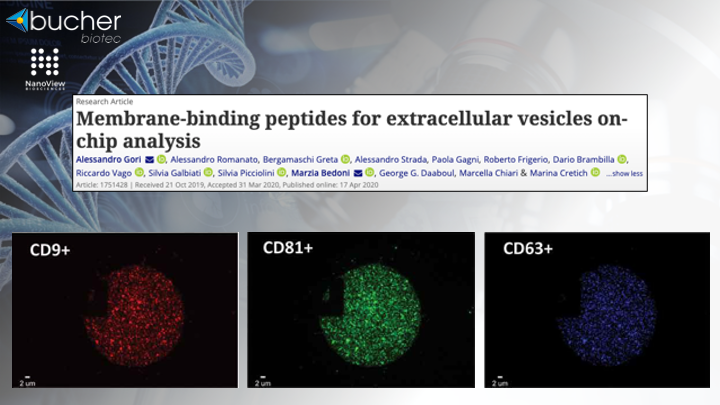 BucherBiotec's tweet photo. Excellent work by Alessandro Gori and his colleagues at @cnr_scitec using membrane binding peptides to capture #extracellular #vesicles on microarray chips for characterization with the #ExoView🔬👨🔬
Check it out: https://t.co/fOuypXquVh
#Scientists #Exosomes #Nanoview #forza https://t.co/iDsoqkoLgm