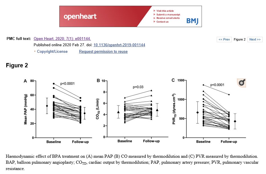 RoyalPapLib's tweet photo. #papworthauthors new publication: Balloon pulmonary angioplasty for inoperable chronic thromboembolic pulmonary hypertension: the UK experience. https://t.co/KzDpn3TVrz. #BalloonPulmonaryAngioplasty #BPA #CTEPH #RightHeartFunction #ConferenceAbstract https://t.co/7aib1U1P6R