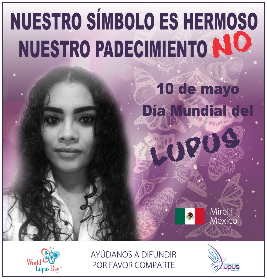 LupusMorelos's tweet photo. Nuestro símbolo es hermoso, nuestro padecimiento NO.
Por la visibilización de los pacientes con #Lupus.
GRACIAS POR INVITARNOS A SU #CAMPAÑALupus paciente Rosa Elisa Vega😀
10 mayo día mundial del Lupus.
#lupusmorelos #lupusmexico #lupusatencionya #diadellupus #worldlupusday https://t.co/9ReisAzxh1
