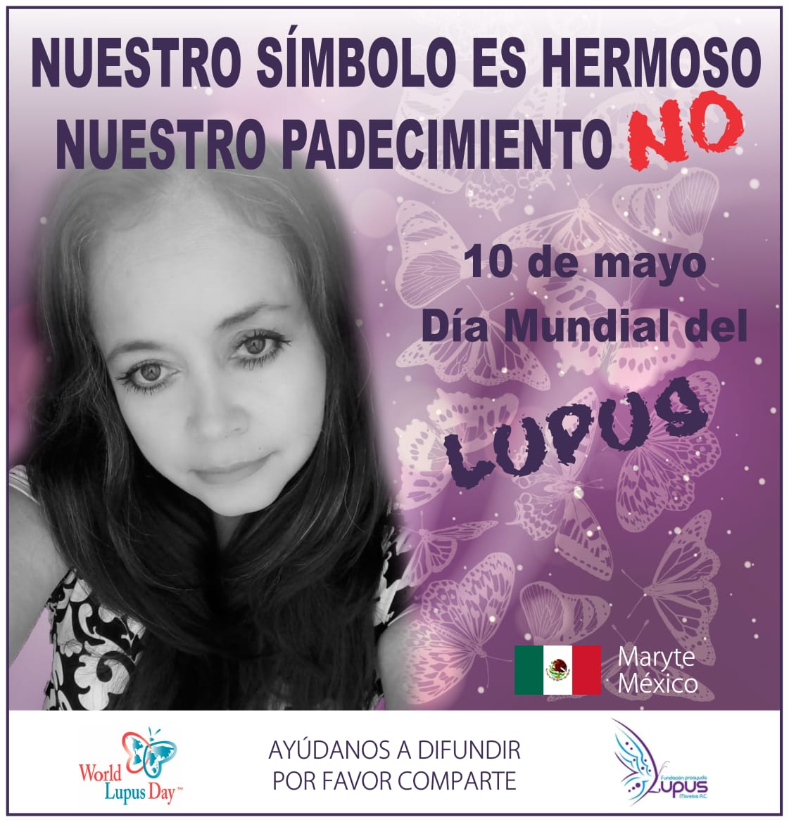 LupusMorelos's tweet photo. Nuestro símbolo es hermoso, nuestro padecimiento NO.
Por la visibilización de los pacientes con #Lupus.
GRACIAS POR INVITARNOS A SU #CAMPAÑALupus paciente Rosa Elisa Vega😀
10 mayo día mundial del Lupus.
#lupusmorelos #lupusmexico #lupusatencionya #diadellupus #worldlupusday https://t.co/9ReisAzxh1
