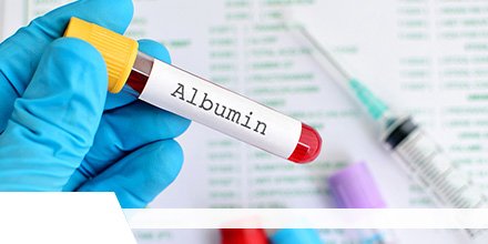 2015-2027 Global #Albumin Industry Market Research Report, Segment by Player, Type, Application, Marketing Channel, and Region
Read at- bit.ly/2Kmdynh

Get report sample- bit.ly/3cESJ2v

<a href="/akronbiotech/">Akron Bio</a> <a href="/merckgroup/">Merck</a> <a href="/CSL/">CSL</a> <a href="/baxter_intl/">Baxter International</a> @Albumedix <a href="/Ventria_Bio/">Ventria Bioscience</a>