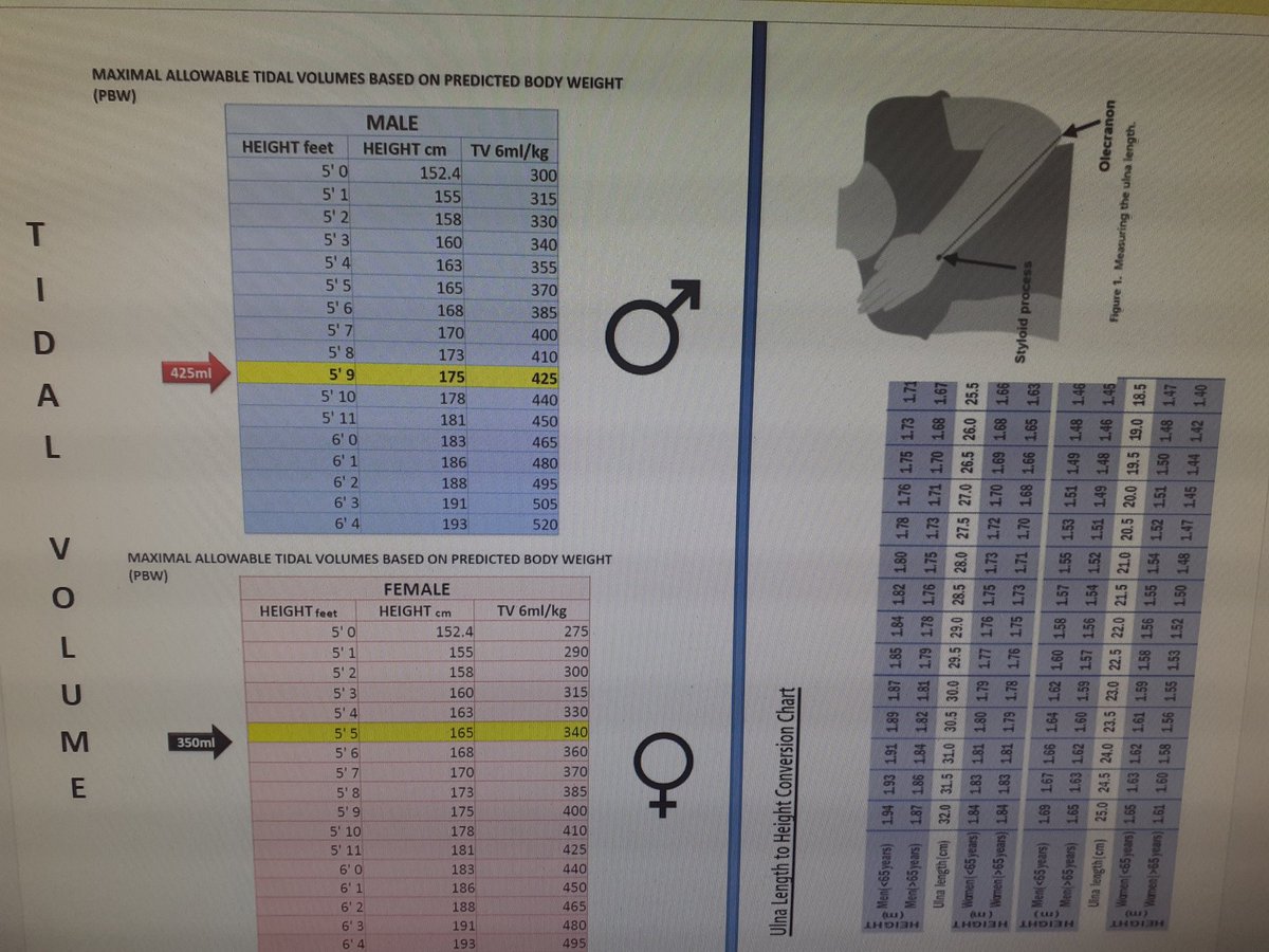 sdkjhfj845t8yg's tweet photo. EM & ICU #ventilation training revising the #ARDSNet #ventilationstrategy.
Calculate PREDICTED/IDEAL BODY WEIGHT using height equation.
#TopTip:ulnar length predicts height, measure from styloid process to olecranon and use the conversion chart! #CriticalCare #TUHworkingtogether https://t.co/kTAhYEK2cW