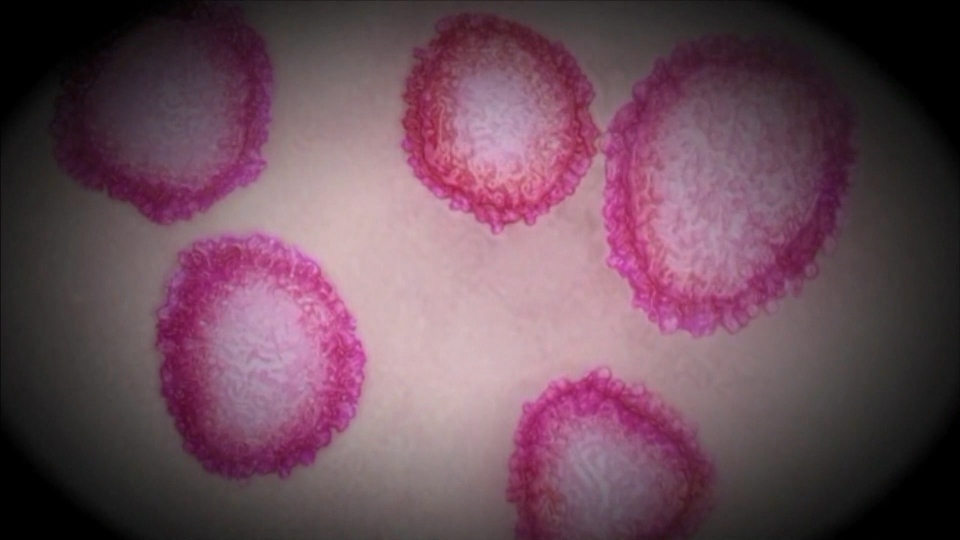 BREAKING: Active COVID-19 cases in Manitoba fall below 100 bit.ly/3bq5DkI