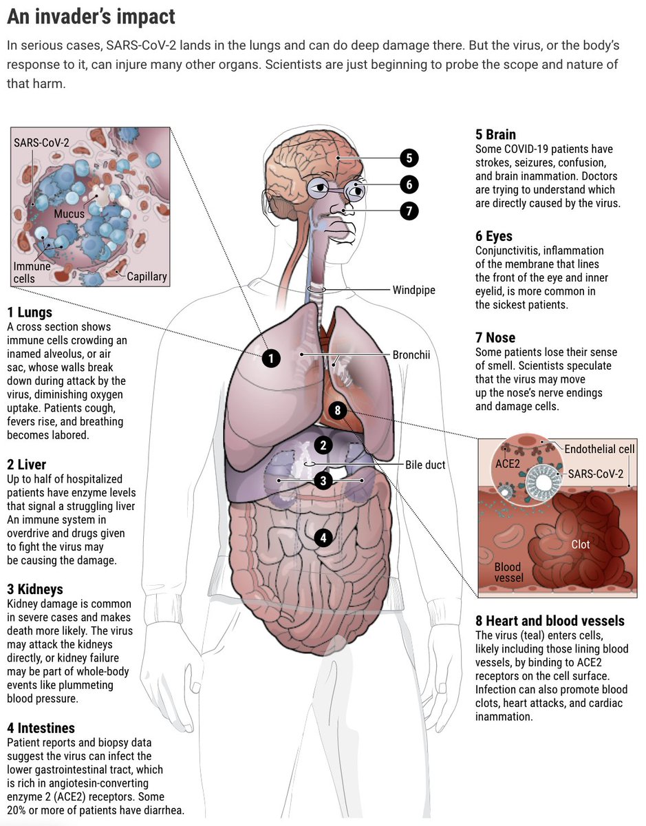 One of my emerging hypotheses is that COVID-19 is an accelerationist virus. It takes a few years off your life. If you're older or in poor health, this may kill you. But for younger people, it *may* shorten life expectancy on average. A hypothesis to test. https://www.sciencemag.org/news/2020/04/how-does-coronavirus-kill-clinicians-trace-ferocious-rampage-through-body-brain-toes#