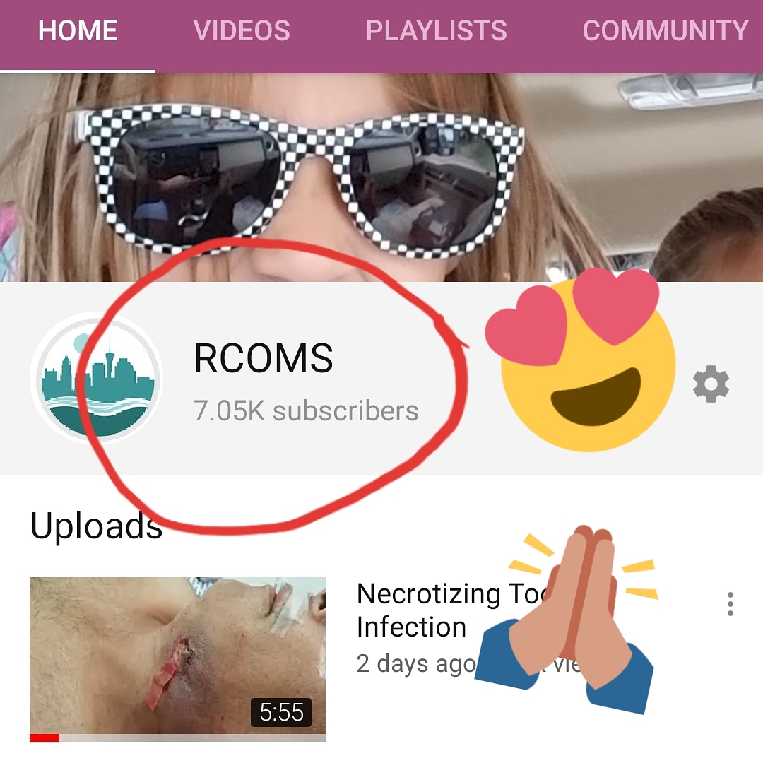 RiverCityOMS's tweet photo. 7000 subs!
https://t.co/Ll06LwU14W
#rivercityoms #RCOMS #oralsurgery #OMS #SanAntonio #Texas #TX https://t.co/kCk6kDBJXw