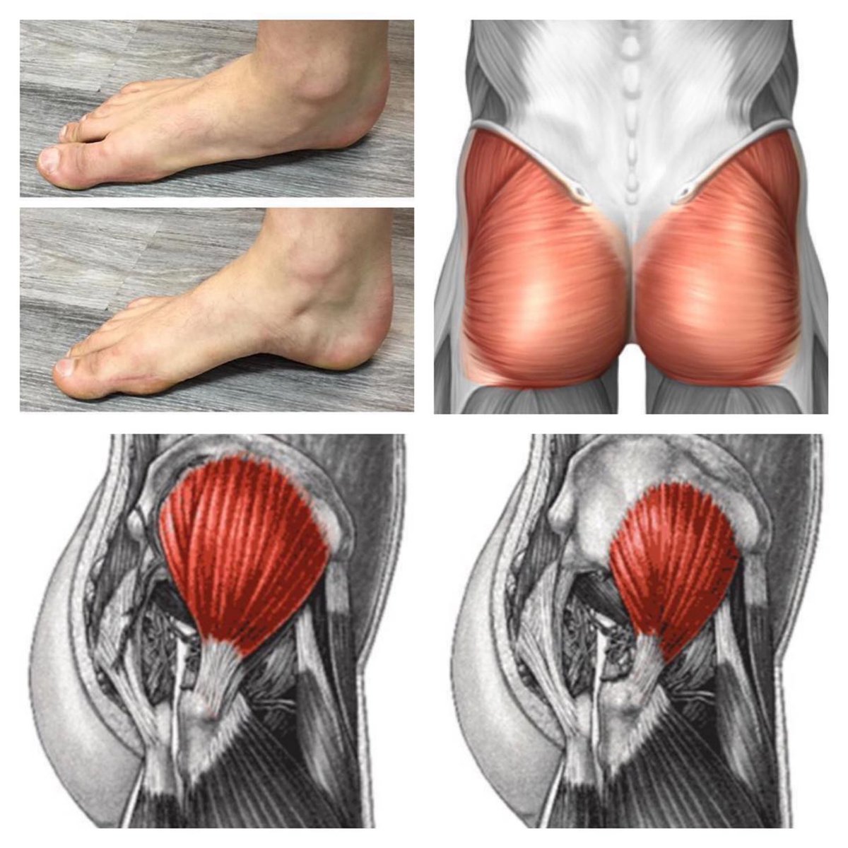 PhysioOsteoGram's tweet photo. GLUTE MUSCLES
⠀
The glutes are the master control muscle for every joint below them including the ankle/foot. This crucial complex of hip stabilizers ensures we have proper balance and stability each time our foot… https://t.co/N1RL9497TC… https://t.co/PMDjBopo0R