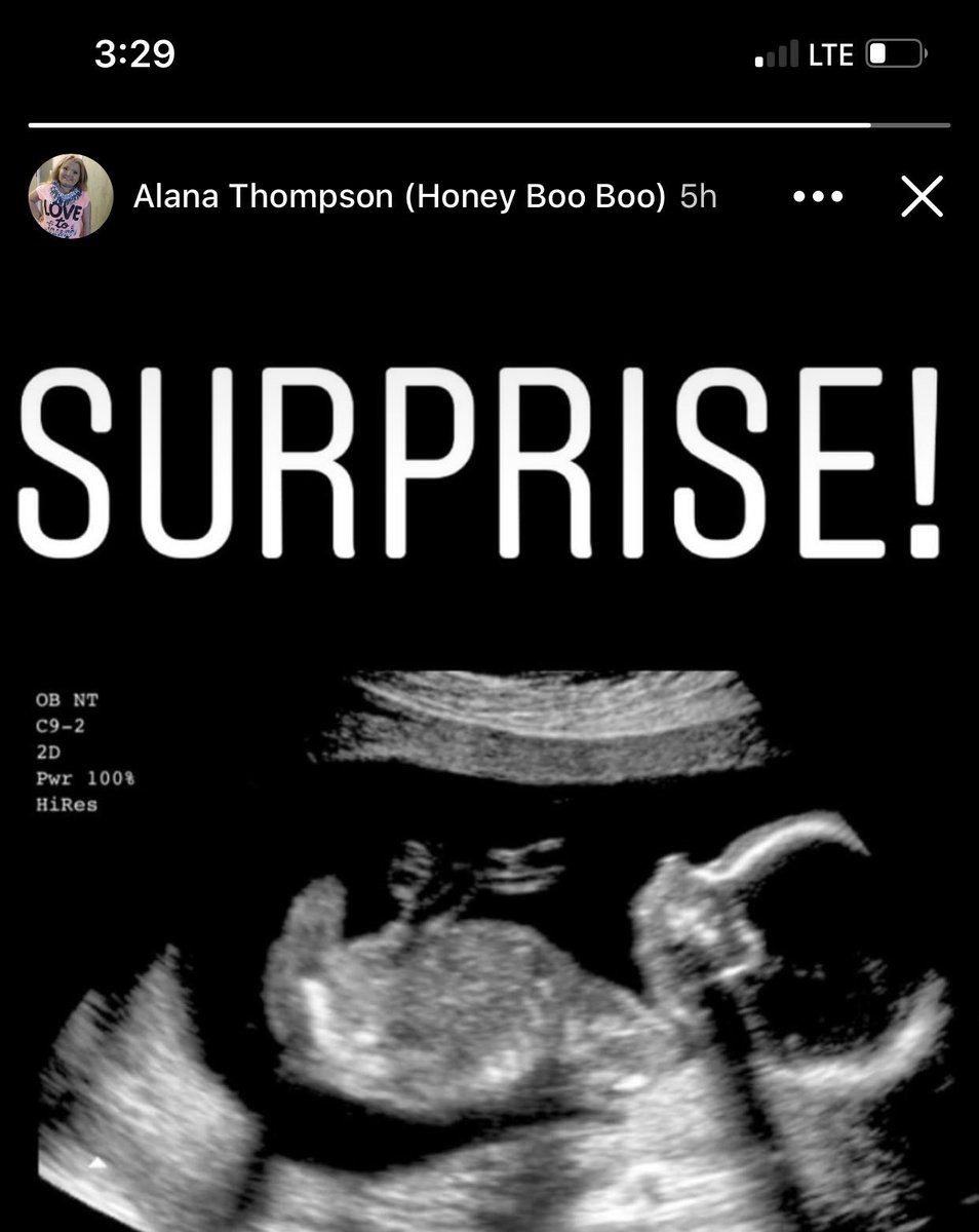 iucipur's tweet photo. Honey boo boo being pregnant is the icing on my mental breakdown cake https://t.co/Ba1JVH03jU