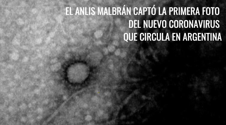 Esta es la primera foto que se logra tomar del virus SARS-CoV-2 del COVID-19 que circula en Argentina. El  @ANLIS_Malbran y UBA CONICET lograron imágenes a nivel microscópico.