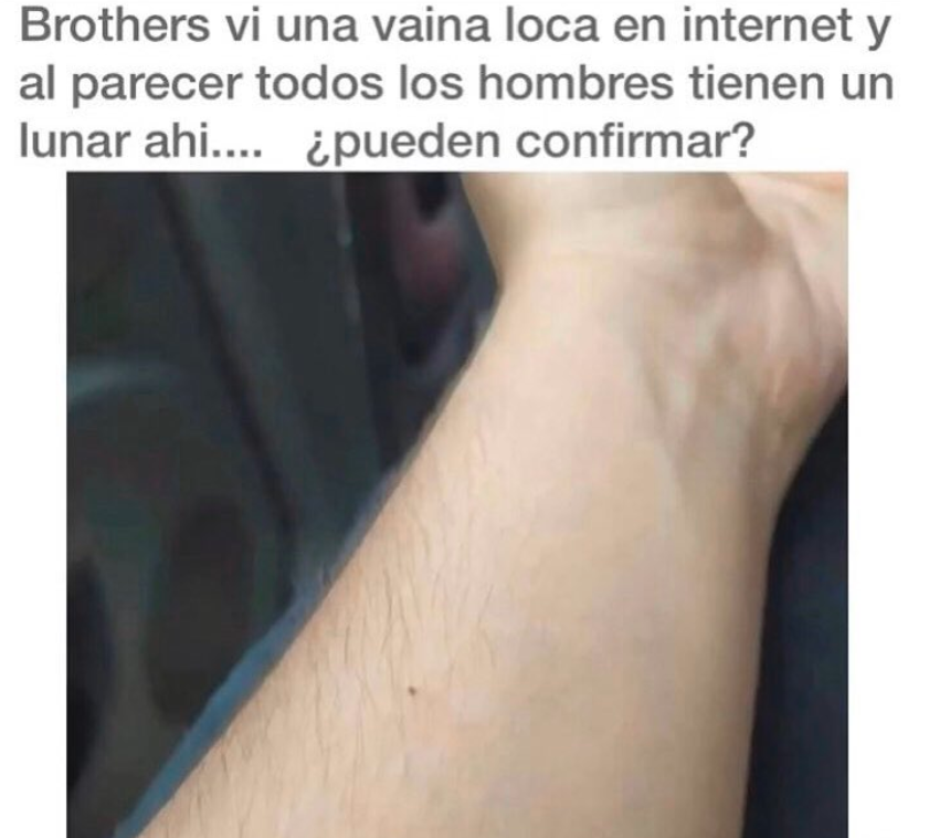 Yo tengo ese lunar justo ahí, real.