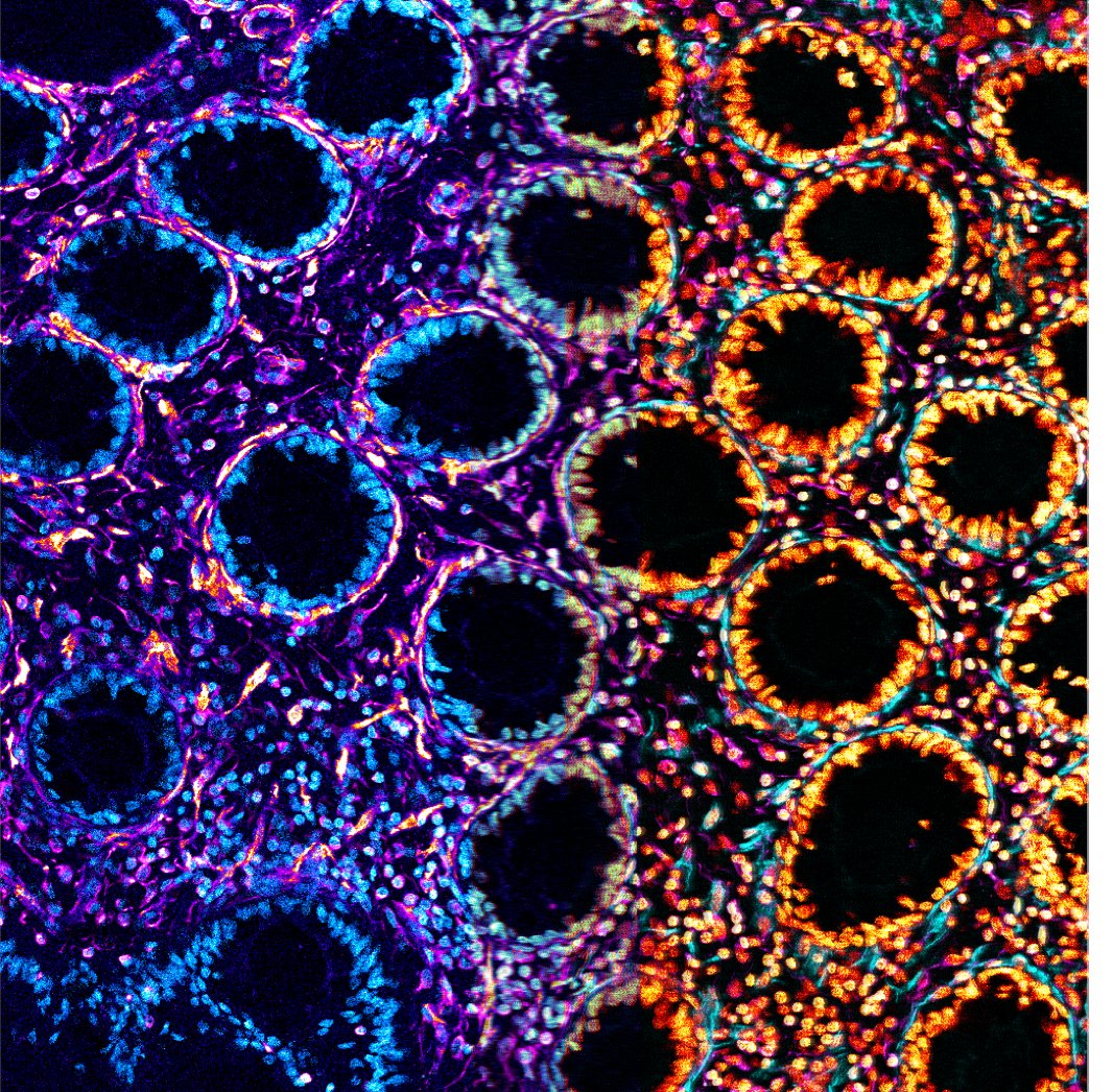 Congratulations to Geraldine Jowett from  @kingsdentistry for being shortlisted for this year's HSDTC  Science Image Competition! Geraldine's image is titled 'Two Faced'.And a big thank you to everyone who entered this year's competition! 5/5