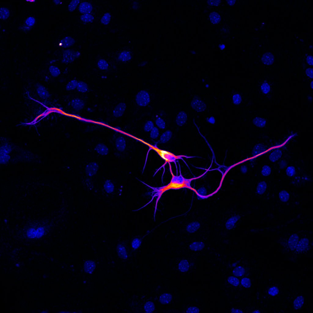 Congratulations to Ieva Berzanskyte from  @KingsIoPPN for being shortlisted for this year's HSDTC  Science Image Competition! Ieva's image is titled 'Ability to hack cell connectivity is the key to repairing broken neural networks in human disease and trauma'...3/5