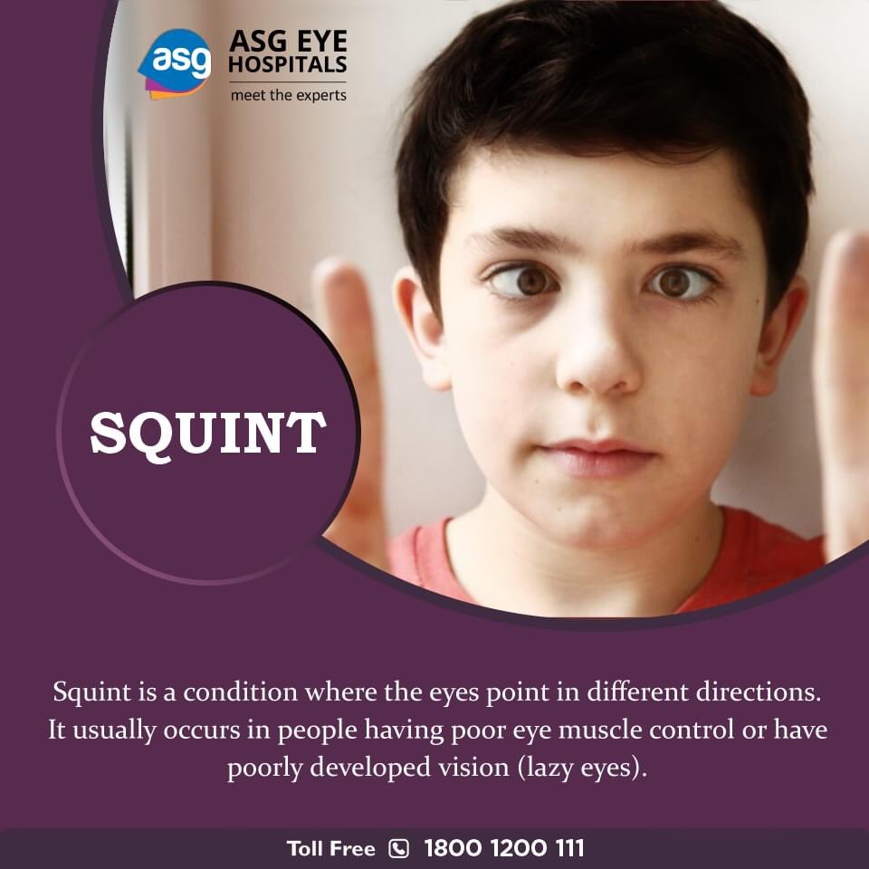 ASGEyeHospitals's tweet photo. Squint is a condition where the eyes point in different directions. It usually occurs in people having poor eye muscle control or have developed vision (lazy eyes)
For any eye related problem or help call us at 1800 1200 111 (Toll Free)
#squint #squintyeye #squintsurgery #eyes https://t.co/M9yLDXo7hm