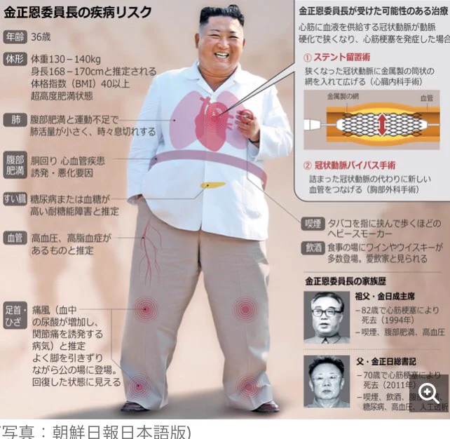 金正恩委員長の健康状態の紹介が、生物図鑑みたいになってて笑えるｗｗｗ