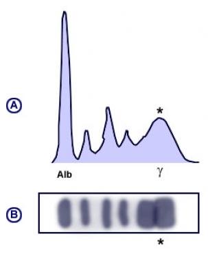 12/ Case #4:What combination of pathologies is this pattern compatible with?