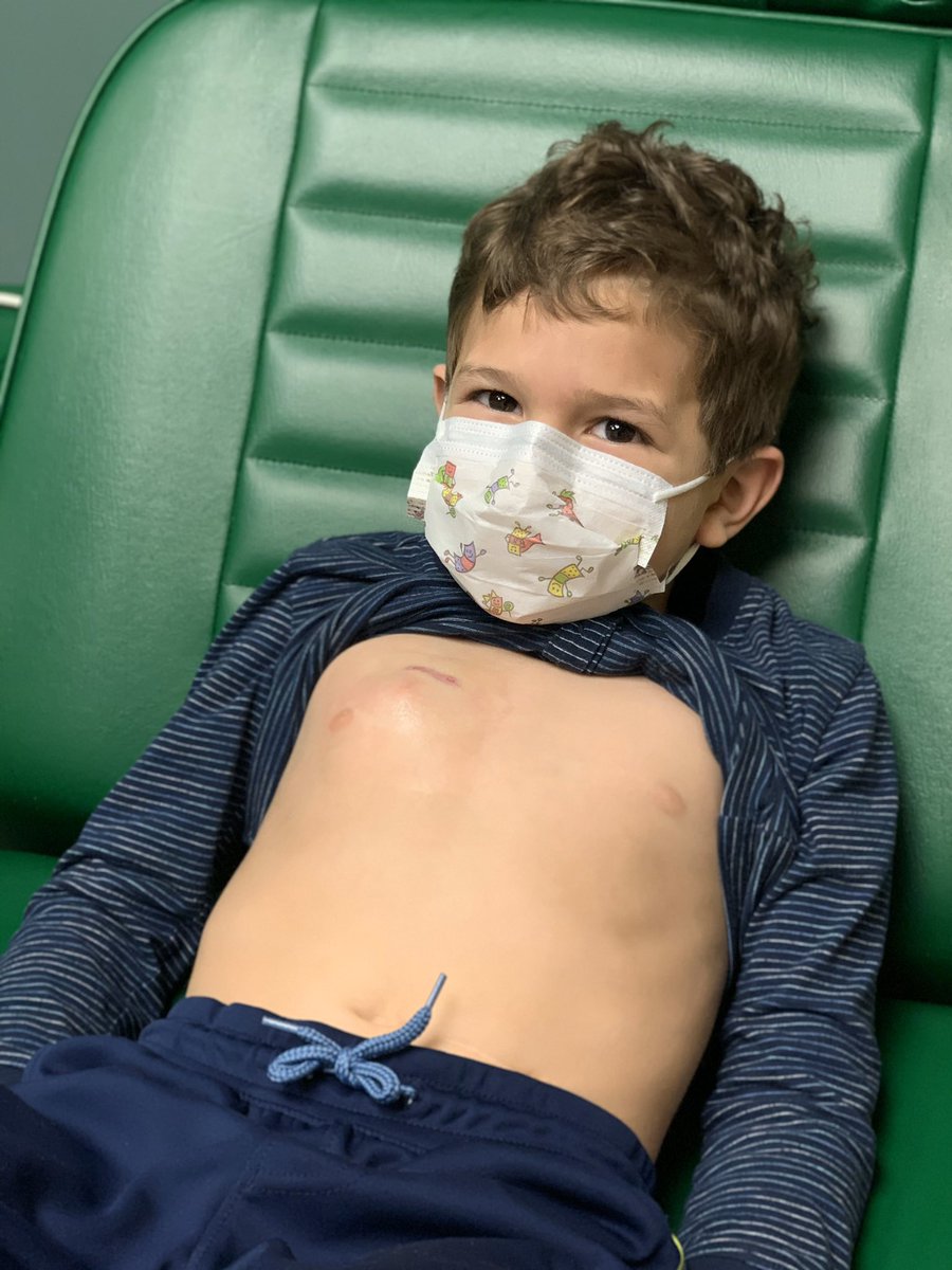 gmuyshondt's tweet photo. Otra vez temrpanito en el hospital.

Hoy toca hacer una resonancia magnética para ver cómo está la cabecita de Pipe.
Pronto empezarán las quimios.

Virus o no, esta lucha sigue... y la seguimos peleando con todas nuestras fuerzas.

Porfa, pidan por él.  🙏🏼 
#TodosSomosPipe https://t.co/zzoYQto2Oc