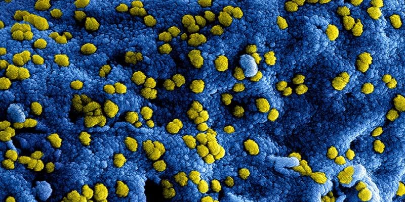 📝 | Update #coronavirus en activiteiten van de KNZB 👇

bit.ly/corona-activit…