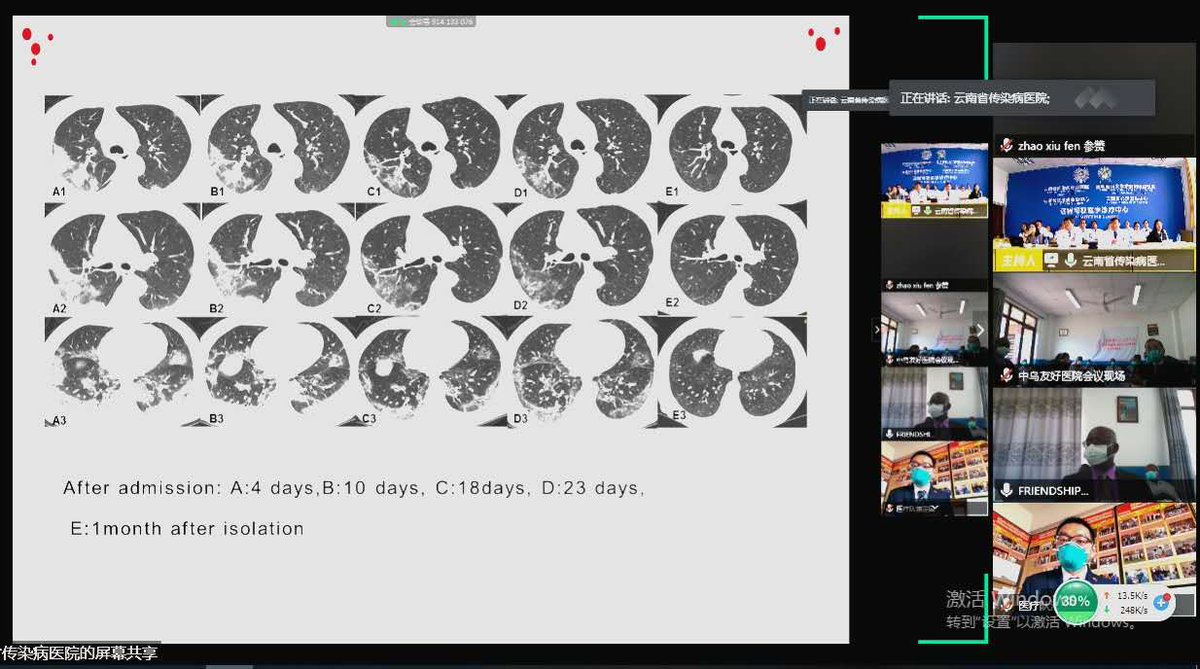 China-Uganda Friendship Hospital and Yunnan Province Infectious Disease Hospital had a Video Conference on sharing experiences on management and treatment of COVID-19.🇺🇬🇨🇳