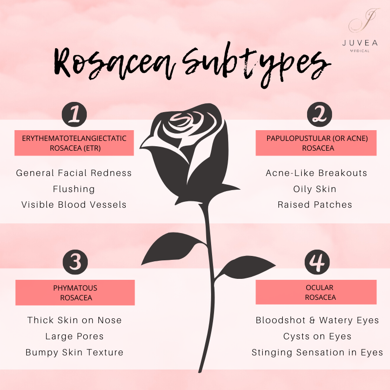 Did you know the 4 rosacea subtypes? 

Here is a quick breakdown of the typical signs of each subtype. Understanding the subtypes can help to treat your symptoms. 

Get in touch if you would like advice on treating rosacea 🌹#rosaceaawarenessmonth