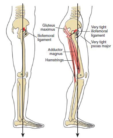 A thread on why we need full hip extension, why it’s often lacking, & how I test for itNormally, upright movement is efficient from a metabolic perspective for us, given we have adequate hip extension.However, prolonged hip flexion and/or an imbalance of anterior to..(1/7)
