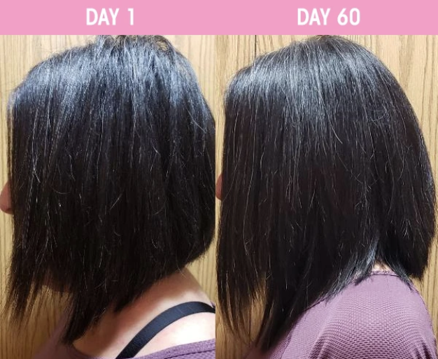STTROPICA's tweet photo. Swipe to read her review! 😍
#customerreview #realcustomerresults #hairgrowth #60dayhairchallenge #hairgrowthvitamins #gorgeoushair #hairgoals #longhairdontcare #productsthatwork #productsyoucantrust #sttropica #sttropicaproducts https://t.co/GncEiq8dVw