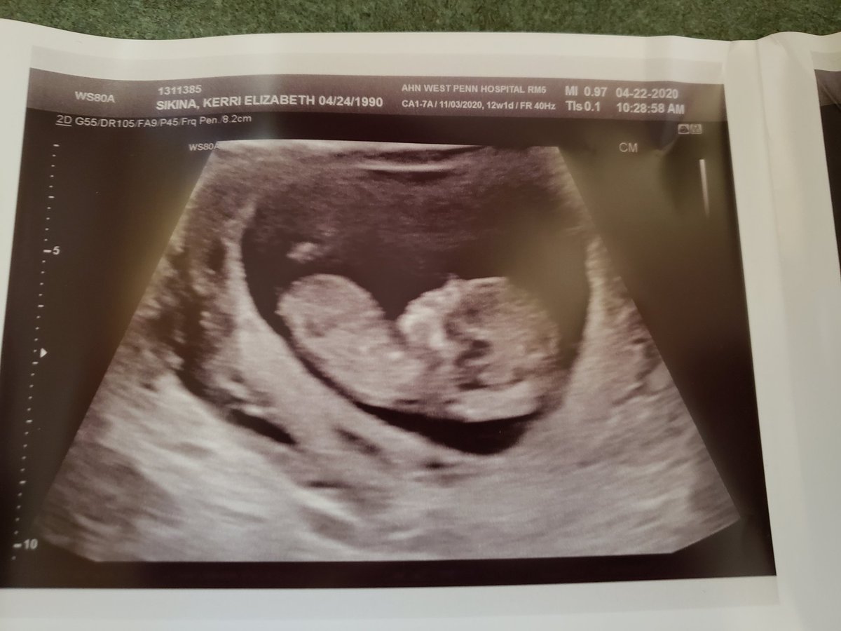 Kpopulo1's tweet photo. Got to see baby today! https://t.co/HMBZK0ZIFM