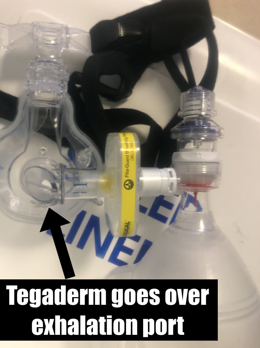 Reflections  #COVID19 nights- Still seeing comfortable hypoxia + still w/o HFNC or BPAP- Critical to learn how to create your own CPAP to avoid intubations- Best solution: make kit w/ BVM, CPAP mask, Viral Filter, PEEP Valve, NC + tegaderm