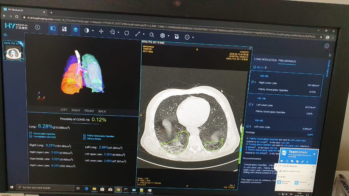 Hospital Regional de Temuco utilizará Inteligencia Artificial para diagnosticar pacientes con sospecha COVID-19
facebook.com/rtvcanal12vict…