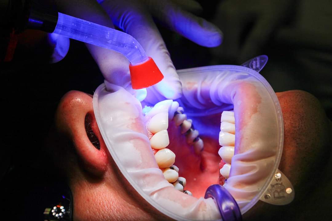 DiemanSA's tweet photo. En Dieman S.A ya estamos trabajando con las novedades de la Luz Ultravioleta UV-C para la eliminación de virus y bacterias en un 99,9%.

Especialmente indicado para negocios o espacios públicos como guarderías, clínicas, oficinas, escuelas, hospitales, fábricas, gimnasios, bares. https://t.co/qKwkoWDhKO