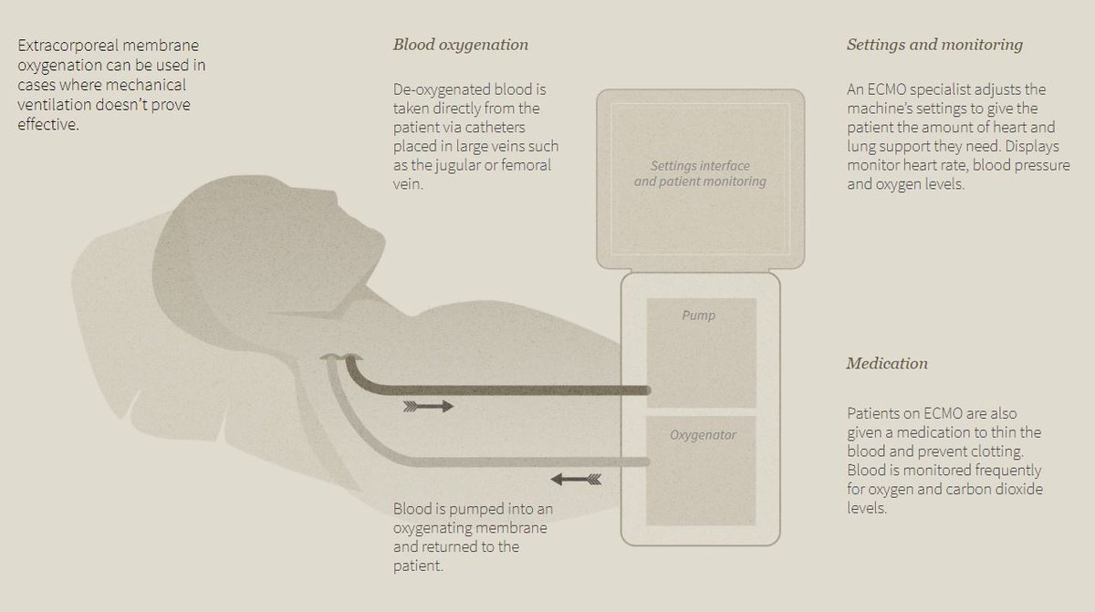 One option recommended by the  @WHO when a patient is not responding to mechanical ventilation is known as extracorporeal membrane oxygenation - a highly invasive treatment in which the lungs are completely bypassed by an external machine. 7/8