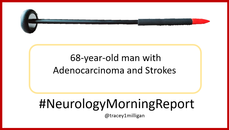  #NeurologyMorningReport Case 27  #MedTwitter Updates & Answers posted later today. Asking your help  #MedEd  #neurology  #neurologyresident  #futureneurologist  #medstudent  #stroke  #oncology  #hematology Join me in educating. Share your questions and knowledge.1/