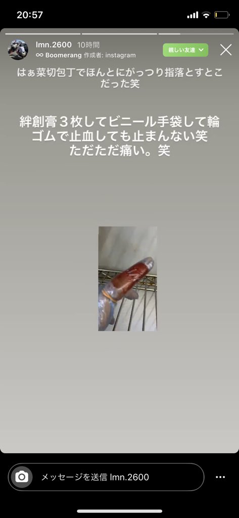 咲 仕事って理由つけて本当はメンヘラなの隠してるのやばくね コロナで気が滅入ってるのかな 何回も指切ってる 隠れメンヘラ 咲 仕事って理由つけて本当はメンヘラなの隠してるのやばくね コロナで気が滅入ってるのかな 何回も指切ってる 隠れメンヘラ