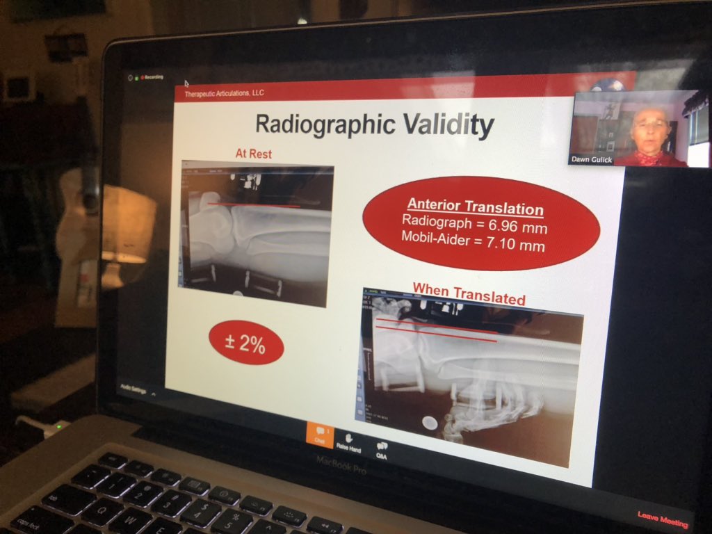 PhilaPACT's tweet photo. #PACTmedtech Webinar LIVE now! Getting warmed up w/ #startup #pitches from #mentorconnectphl @iOrthoApp & Pression! Sponsored by @DuaneMorrisLLP @EisnerAmper @RSMUSLLP @PennPCI @FoxRothschild Also featuring @AdvaMedUpdate @PennHealthTech #medtech response to #COVID19 https://t.co/qx89Jmtr3M