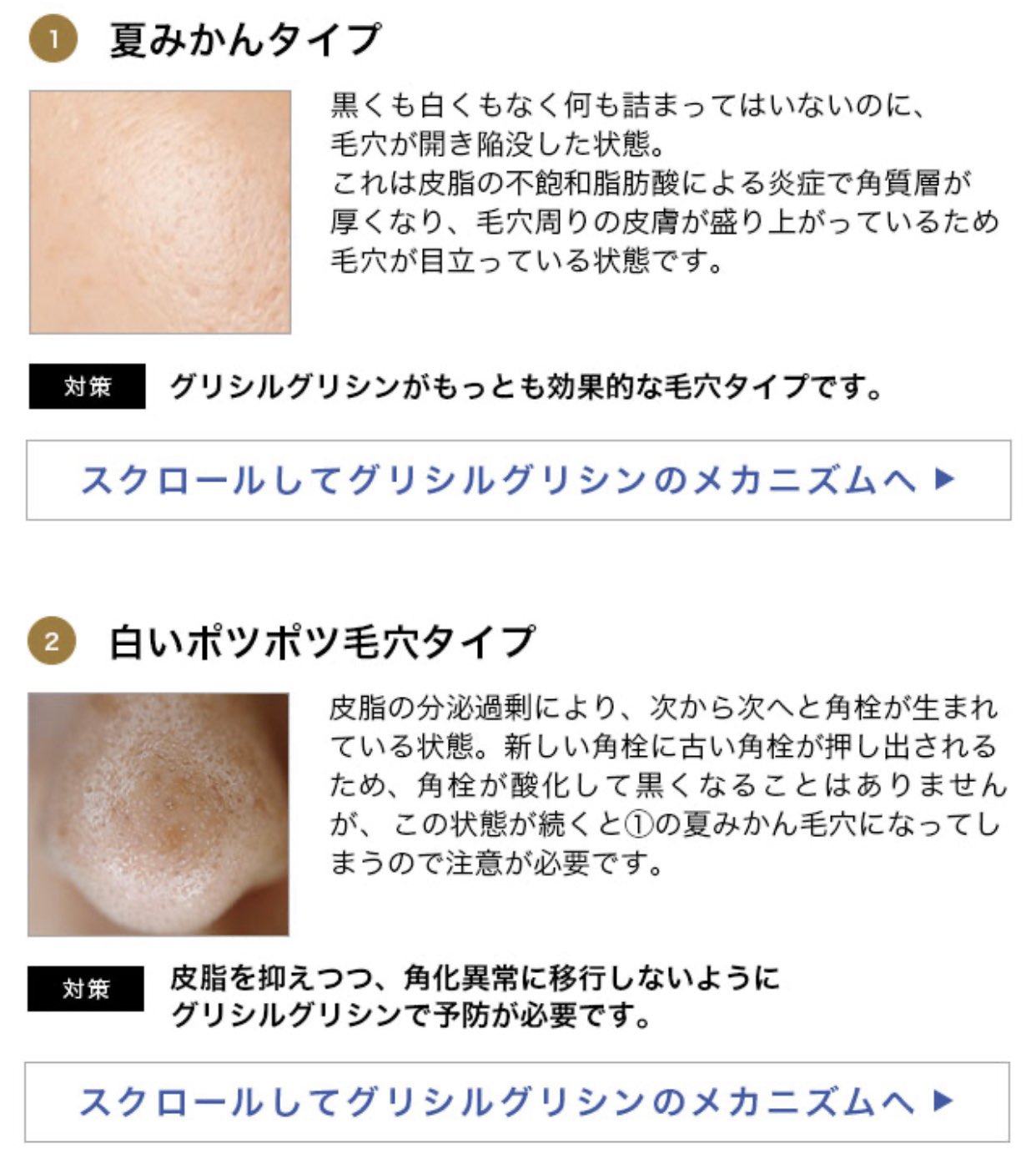 いちご鼻と戦うちゃん V Twitter マンデイムーンに載っていた4つの毛穴タイプ T Co Bgkyyhnlix 黒いポツポツ毛穴タイプは グリシルグリシンよりも効果的なスキンケア原料があります と書かれていて あまり推していないみたい T Co
