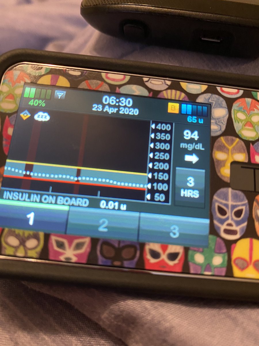 dulcesitosmios's tweet image. Para mi, una (una de una larga lista) de las más grandes ventajas de los sistemas de circuito cerrado de dosificación de insulina es sin duda permitir el sueño ininterrumpido. #bombadeinsulina #tslim