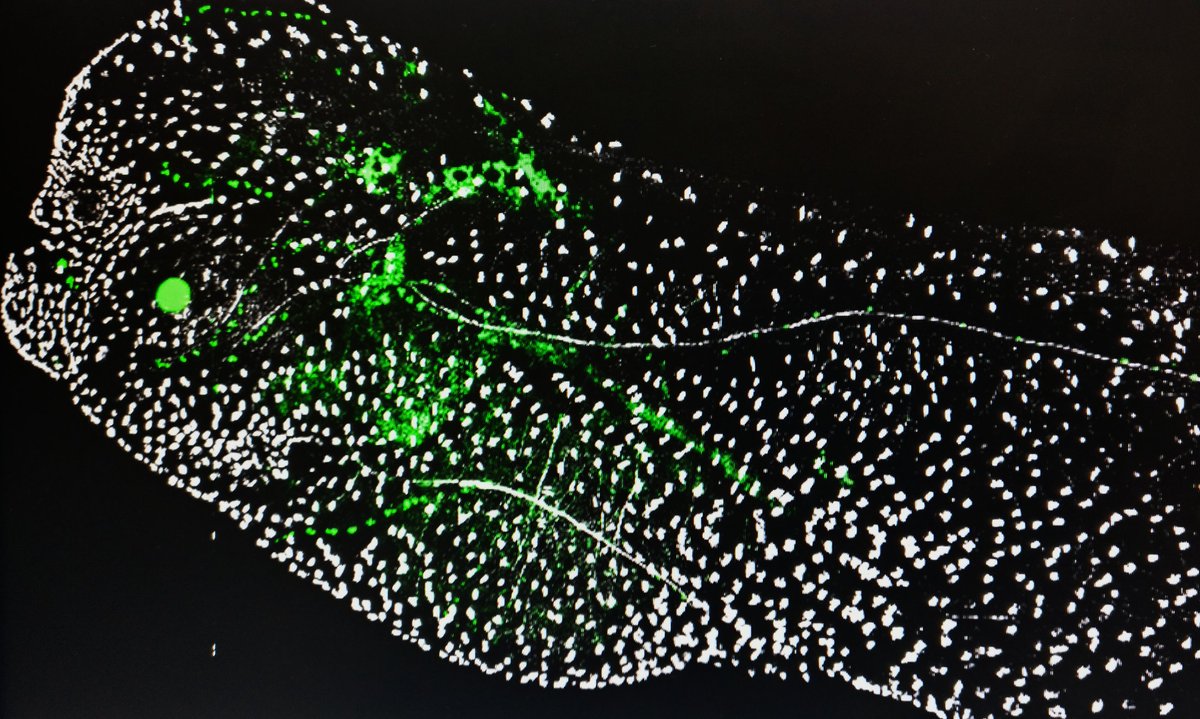 ...and my research has metamorphosed from   #leftrightasymmetry to modelling   #chronic   #lung   #disease still using   #xenopus studying   #cilia ted cell   #transdifferentiation  https://www.biorxiv.org/content/1...