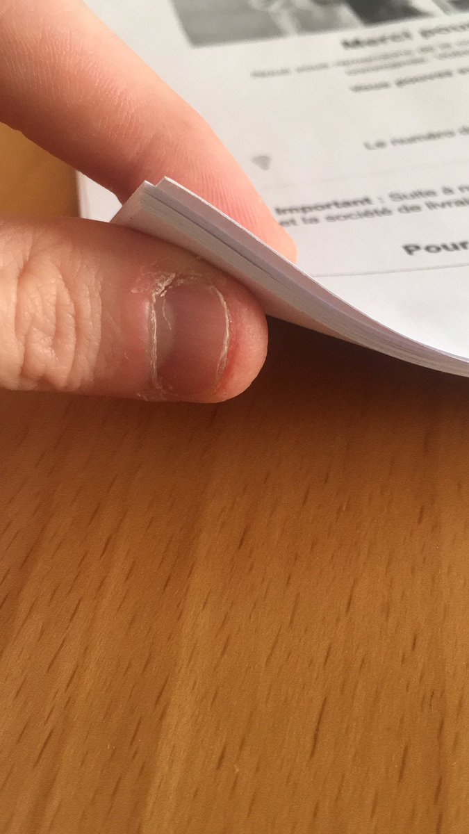 LinkerFR's tweet photo. Voilà un bon dossier contre Slimiies qui va être déposé à la police ... Vous êtes tellement dans la merde https://t.co/xuSqvYgCsF