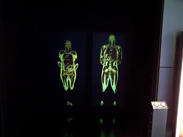 davepatten's tweet photo. Museum photo of the day - Visible Human - one of the original WellcomeWing talking points #museumphotooftheday #sciencemuseum #visiblehuman #projection #bodies #wellcomeWing #inside #medical #2000 #talkingpoint
@scincemuseum https://t.co/I1teWlvOPX