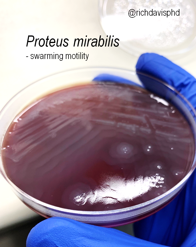 richdavisphd's tweet photo. Another MLS student is @NolenScuba 

One of the best looking, worst smelling (IMO) Gram negatives is Proteus which can, but doesn't always, swarm over plates when it grows in culture. 

#LabWeek2020 #VirtualLabWeek #MLPW2020 https://t.co/iFWm9uC3Bf