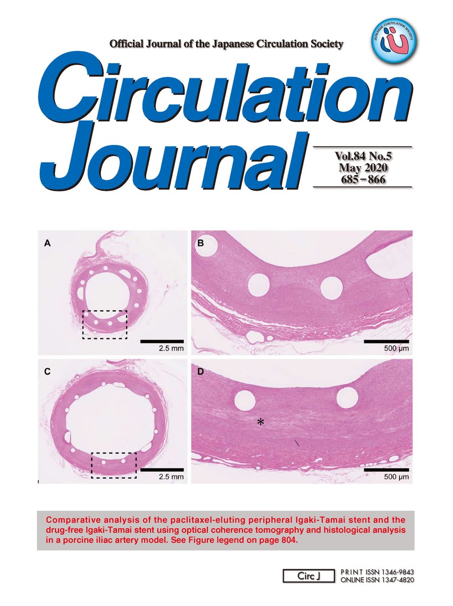 日本循環器学会 情報広報部会 On Twitter 本日は 日本循環器学会 日循 Jcs 公式ジャーナル Circulation Journal Circ J 84巻5号の刊行日です 厳しい査読を経て採択された掲載論文24本は J Stageプラットフォームからどなたでも無料でご覧いただけます Https T