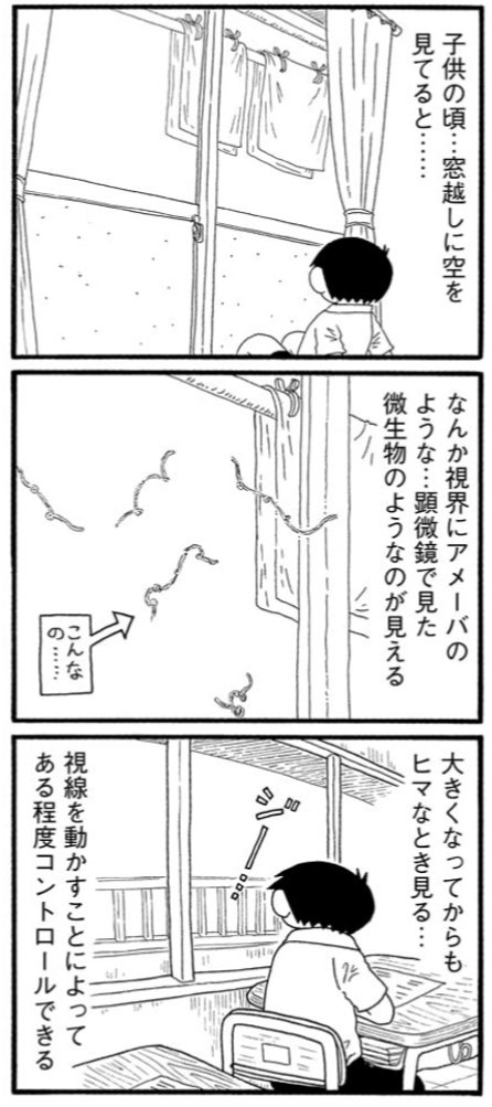 Zyl On Twitter 福満しげゆきさんの うちの妻ってどうでしょう 1巻を再読していて思い出したのですが この透明な糸状のもの 実は私も小学生ぐらいの頃から見えてました 同じような経験ある方いますか 実は見える理由もわかっています 飛蚊症ではなく健康な