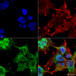 StressMarq's tweet photo. Check out the 5 ⭐ review for our Anti-#VDAC1 Antibody! So good they had to use it at 1:10,000 dilution for WB! https://t.co/vedMbmx5C9 https://t.co/X0MQkzOJlo