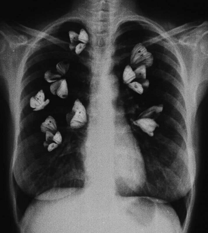 ( 💋 )* 𓈒

   𝕳𝖎 𝖌𝖎𝖗𝖑𝖘 ,เค้า ˓ 𝕲ob𝖌ab 𓐄 𝕾𝖊𝖚𝖑𝖌𝖎 ˒ 𝖒𝖆𝖉𝖊 𝖎𝖓 94’𝖘 𝖈𝖔𝖔𝖑 𝖐𝖎𝖉𝖘 🍷 วันนี้มาทำการ ˓ แลกฟอล 𝖓 ตามทัก ˒ 𝖏𝖚𝖘𝖙 rt 𝖙𝖍𝖎𝖘 𝖙𝖜𝖊𝖊𝖙 𓈒

    ,  ยพท ลฟตท 🦇