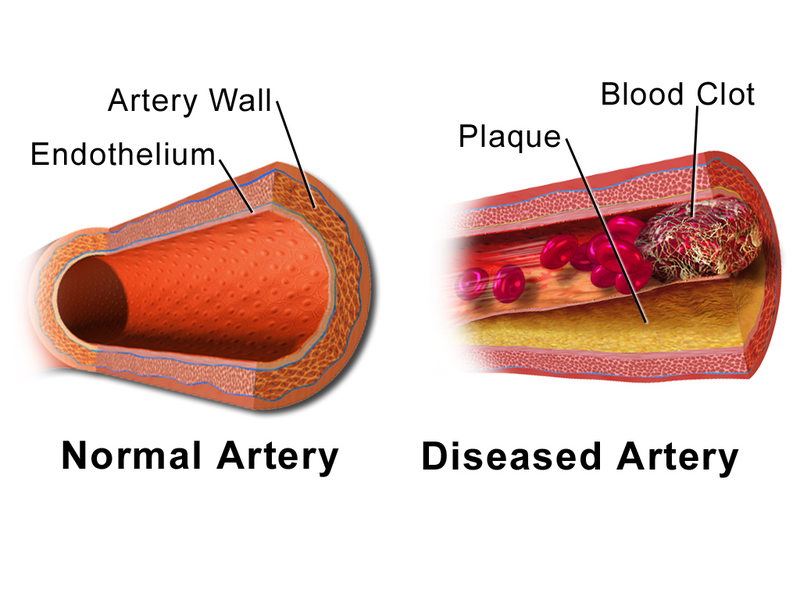 Period Clots