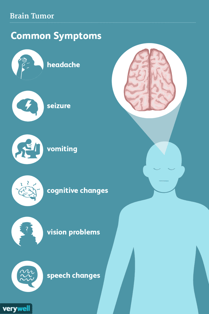 TomsTrust2's tweet photo. We all need to know the symptoms, it's easier to treat the earlier it is found.
#tomstrust #braintumor https://t.co/GSdvR0Z98m