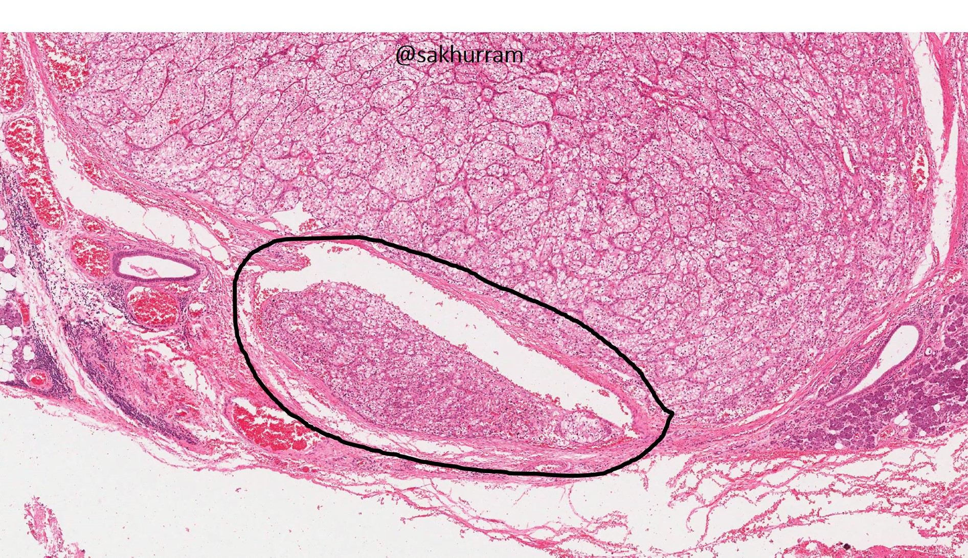 hx-rcc-top-quality-ids-deutschland-de
