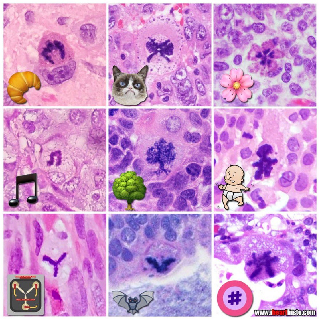IHeartHisto's tweet photo. 🧬Atypical Mitosis on National DNA Day🧬

o > 0 > 8 > oo

Some normal objects in the nuclei of abnormally dividing cells

#histology #anatomy #pathology

📷 @belinda_lategan @AdamGomezMD @dr_MPrieto @ortens84 @janavarro_MD @jcgarcespath @AnAtomicPath @GeronimoJrLapac https://t.co/8M65ZX5iai
