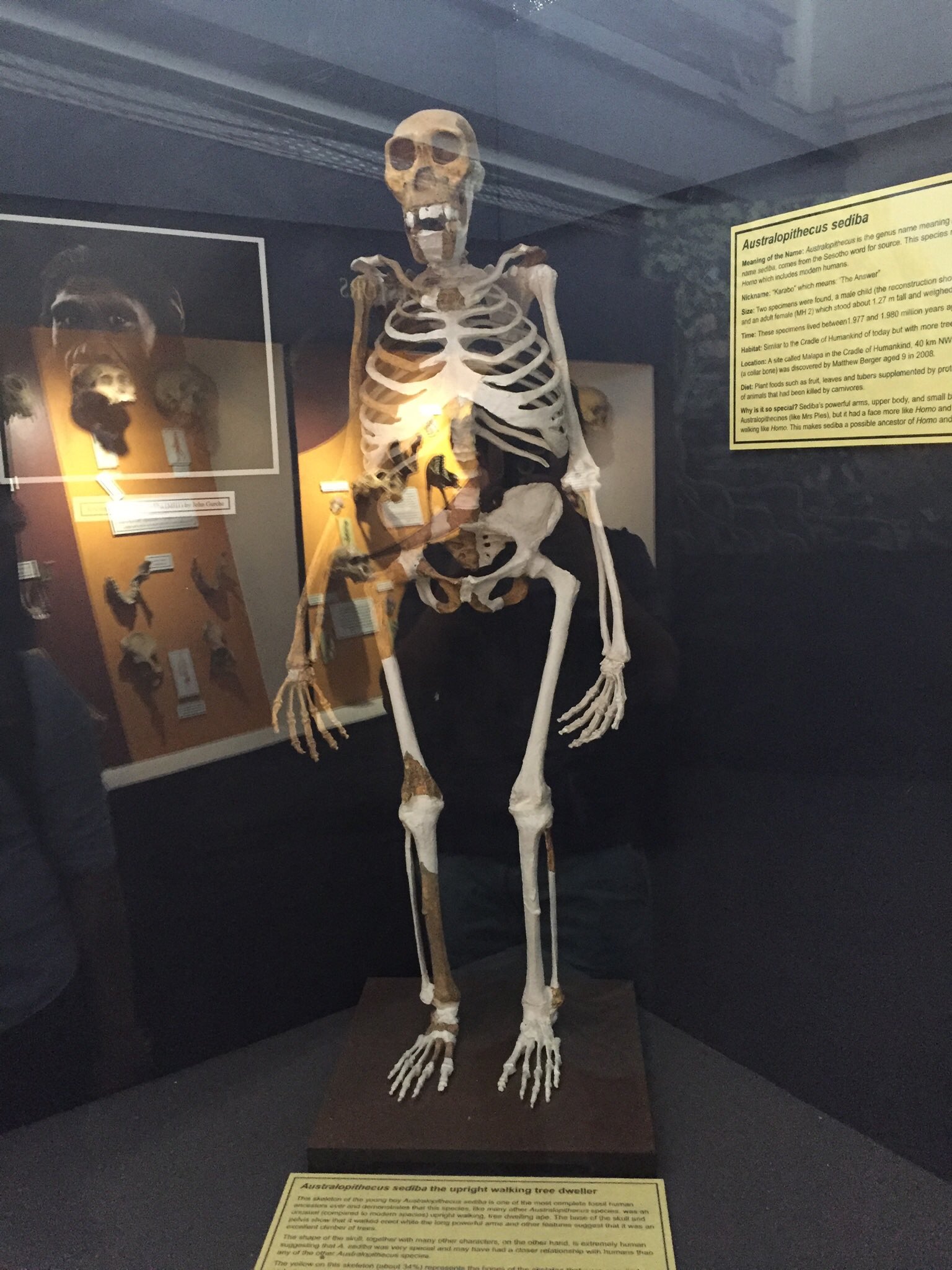 Australopithecus Sediba Pelvis